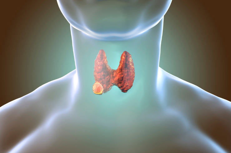 Thyroid Disorders